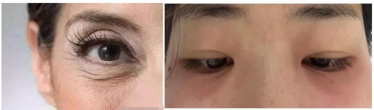 Sensitive Skin Eye Serum